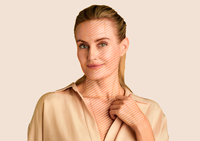 Tiefenhydratation mit Hyaluron (Restylane® Skinboosters™)