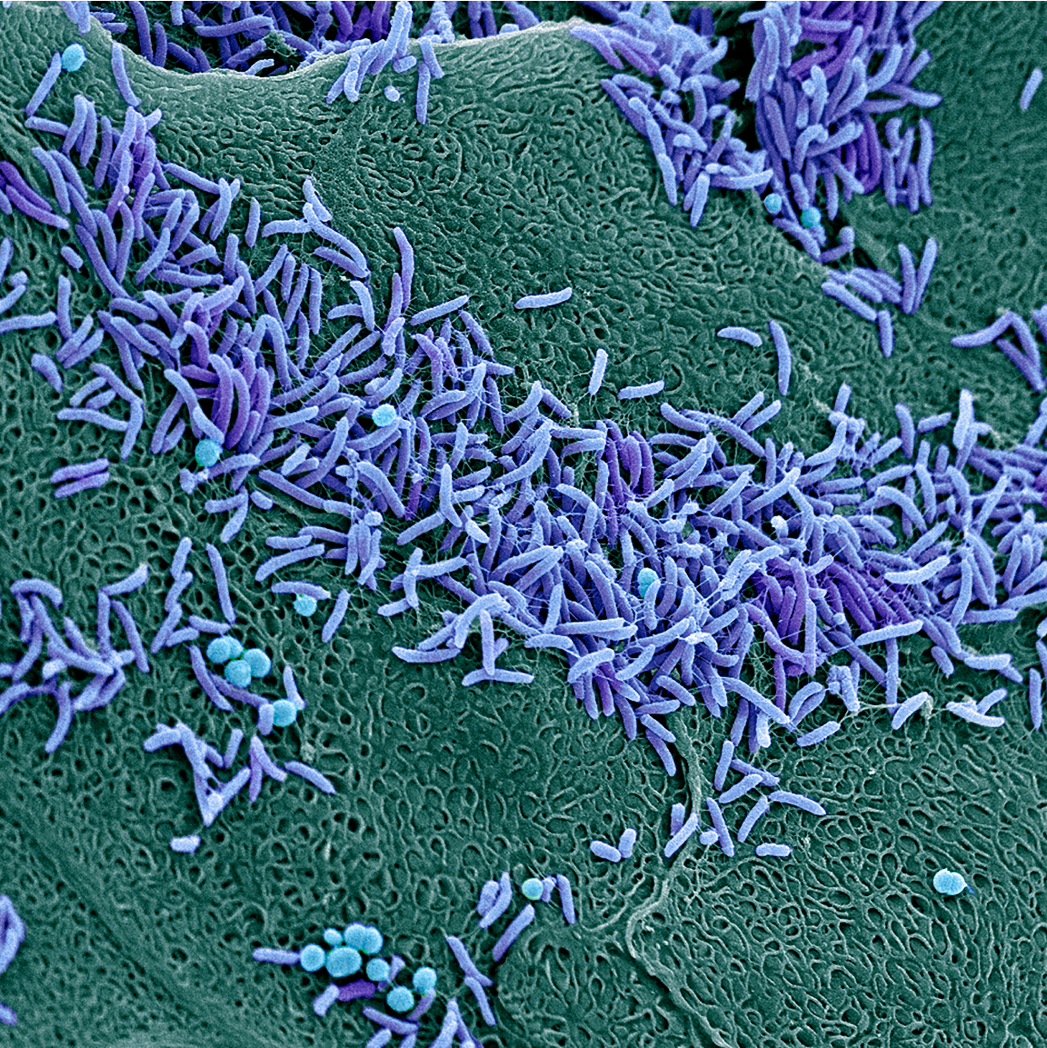 Colored scanning electron micrograph (SEM) of bacteria on the vaginal wall
