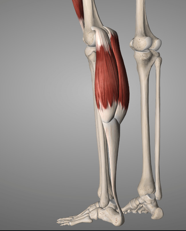 Severs disease at the achilles tendon