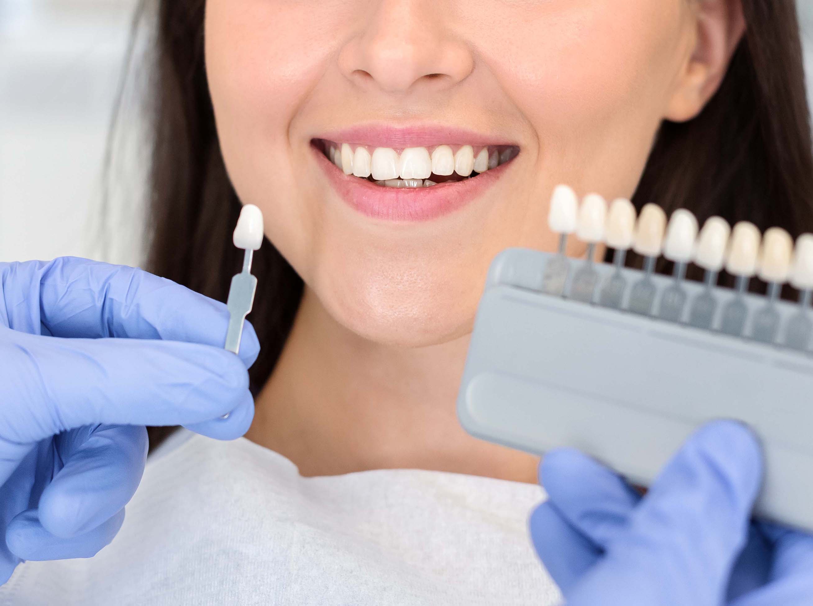 Whitening, Cleaning, Cosmetic Proceadures