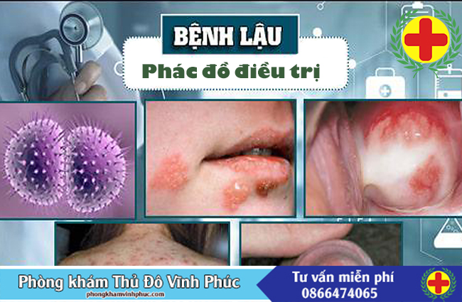 phác đồ điều trị bệnh lậu