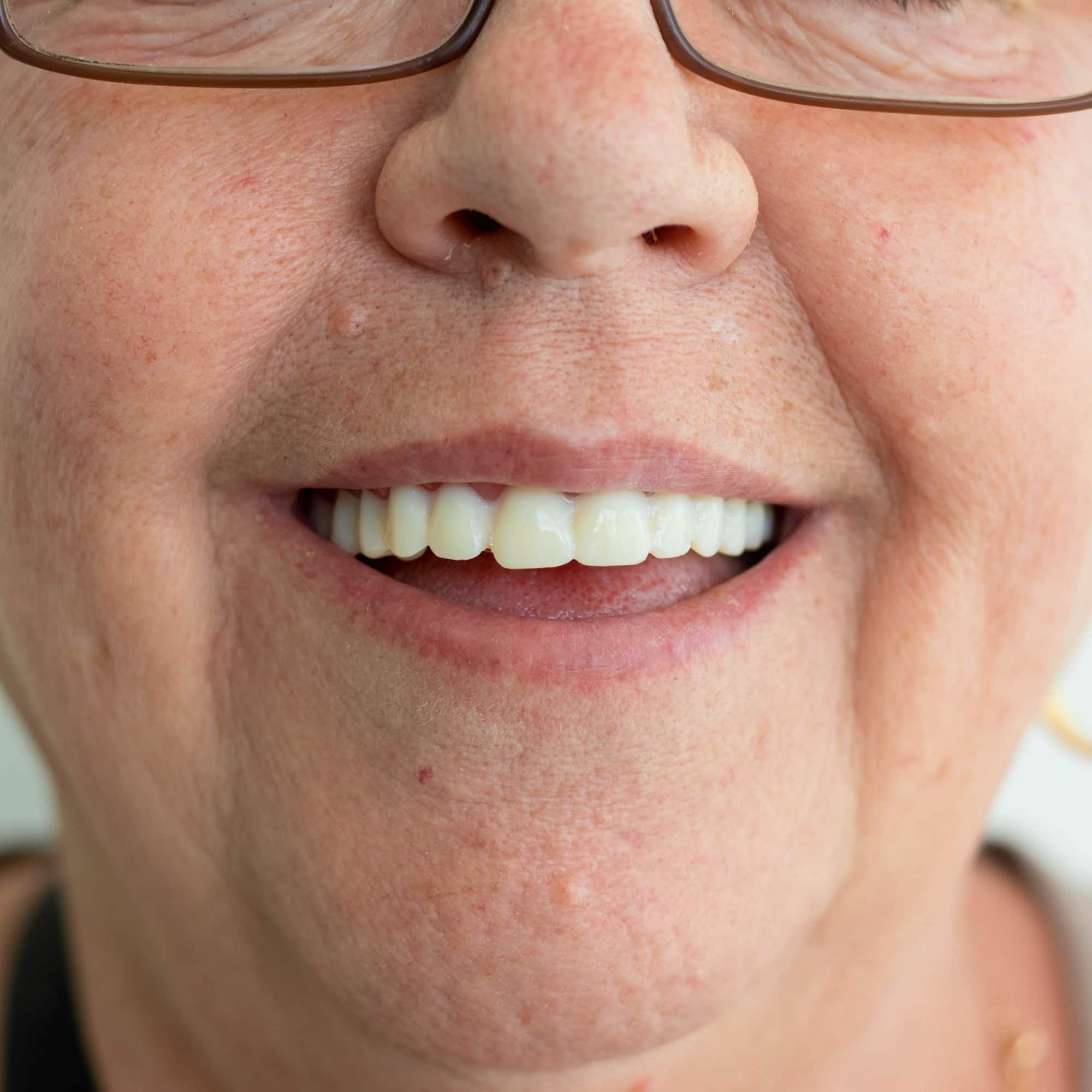 Russell Klein Dentures: The Future Of Denture Technology - uoyq3d3