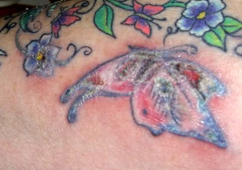 infected tattoo pictures 2
