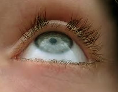 eyelashes falling out