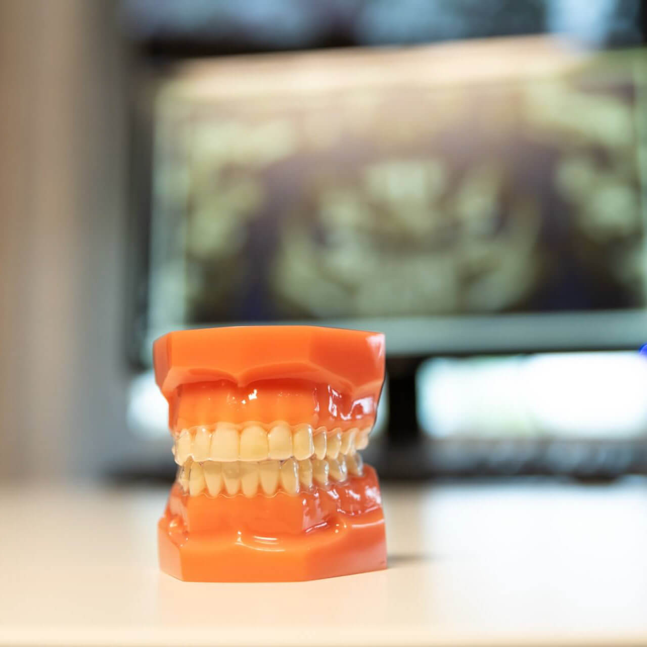 Invisalign can help improve your smile and gum health