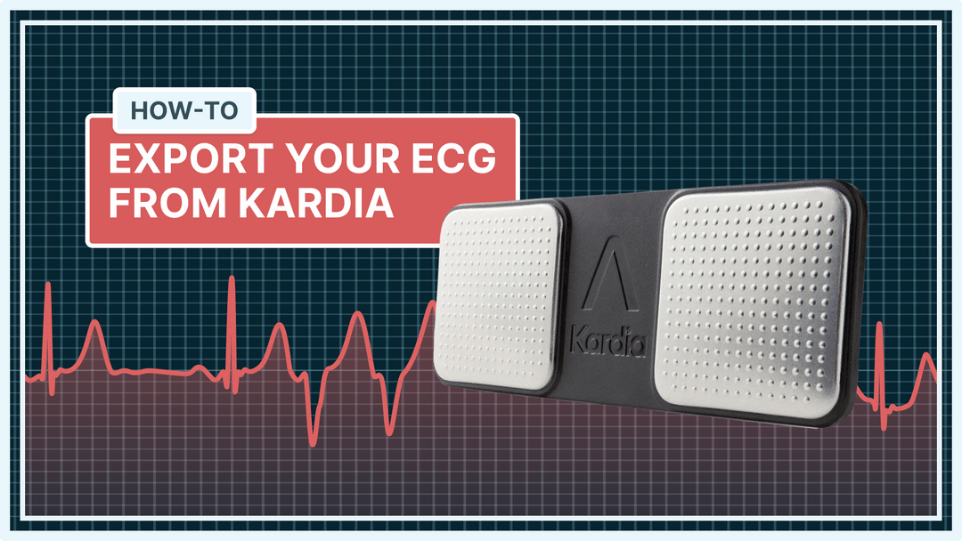 qaly-export-your-ecg-from-kardia