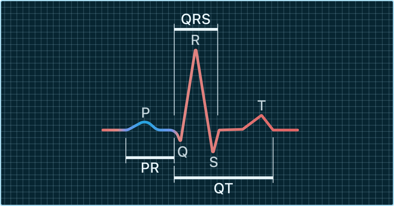 PR interval in ECG