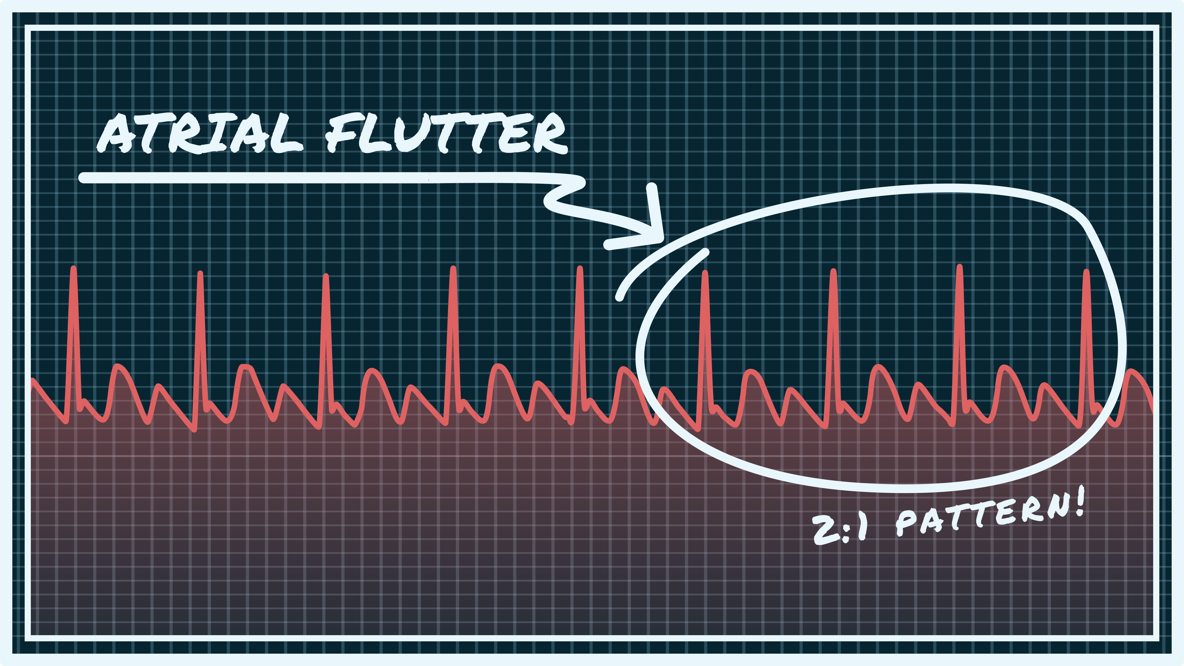 Is That A Flutter?  How To Know If It'S Real Love - byw2yjl