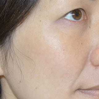 Image of our customer Rachel after using our product