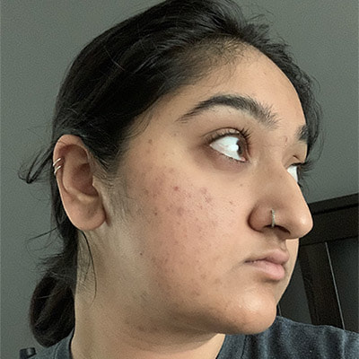 Image of our customer Rachel after using our product