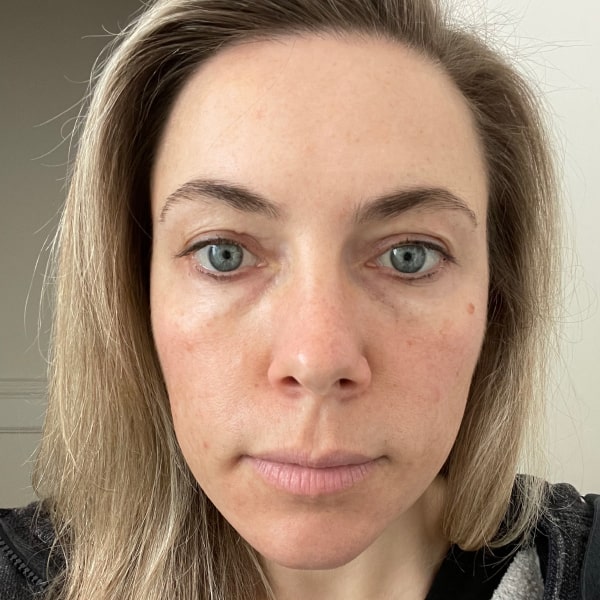 Image of our customer Rachel before using our product
