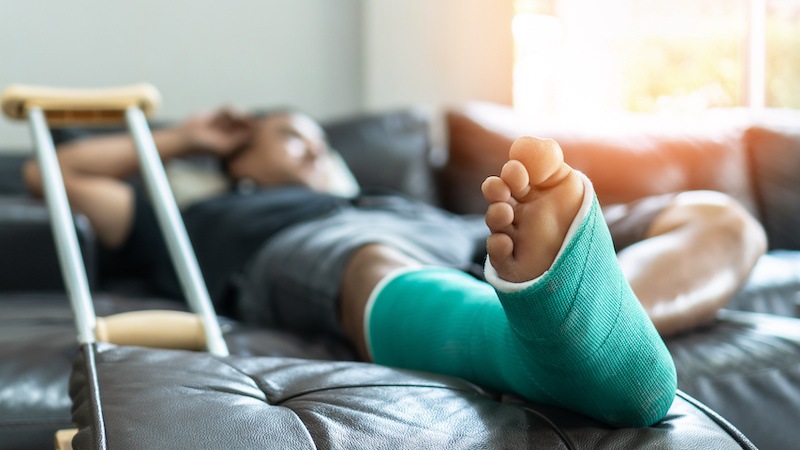 injured man laying on couch with leg cast on