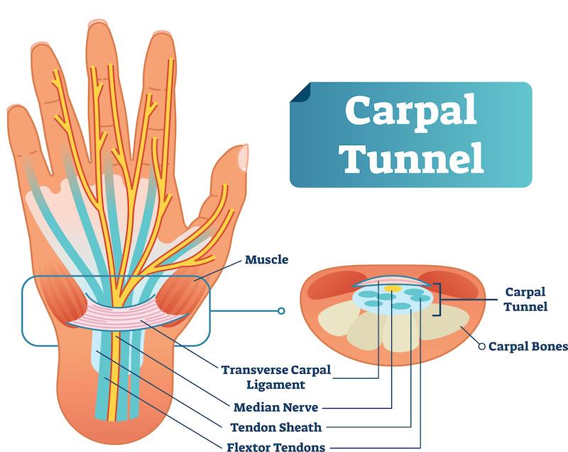 diagram of the hand showing the carpal tunnel