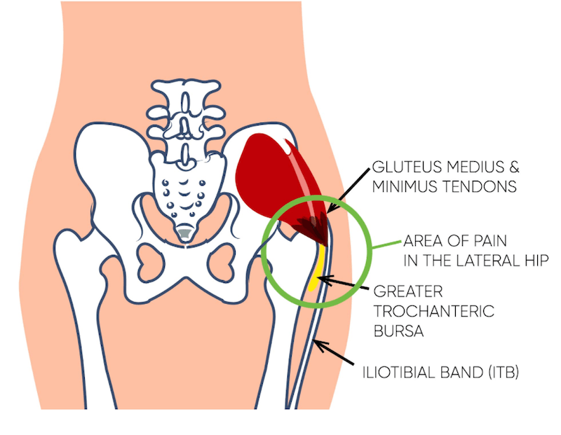 Diagram of muscles and tendons in the hip and buttock