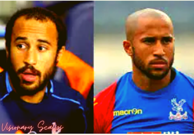 Andros Townsend with Scalp Micropigmentation
