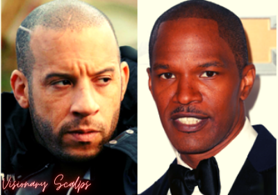 Jamie Foxx with Scalp Micropigmentation