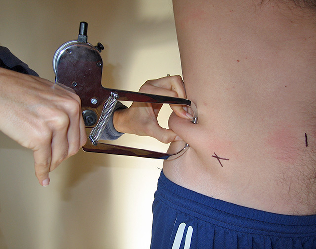 A nutritionist taking a skinfold measurement