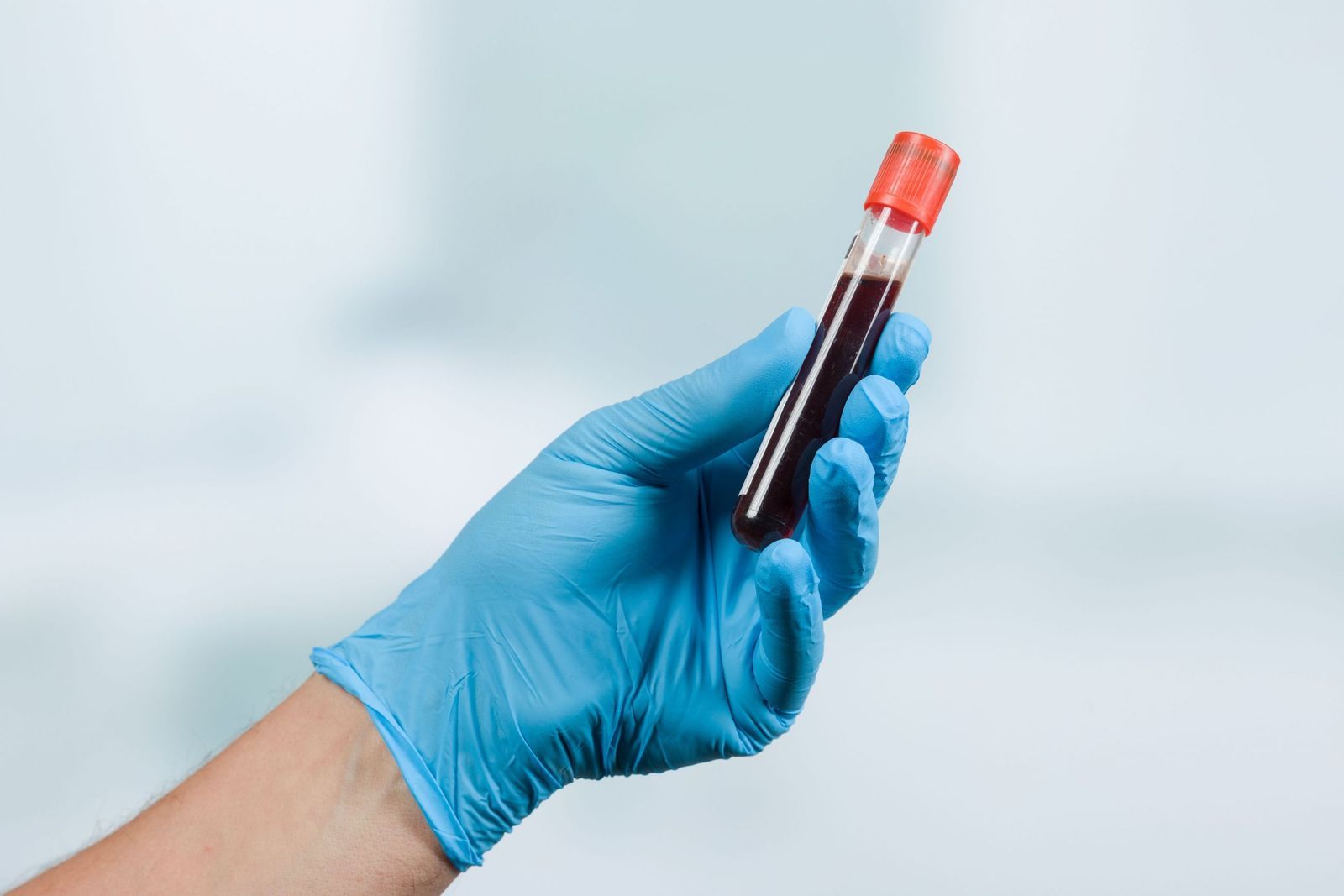 10 reasons why blood tests are important? Understanding blood tests