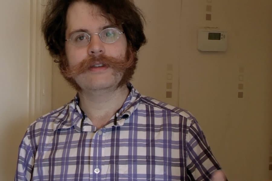 Young man with autism looking bewildered at camera