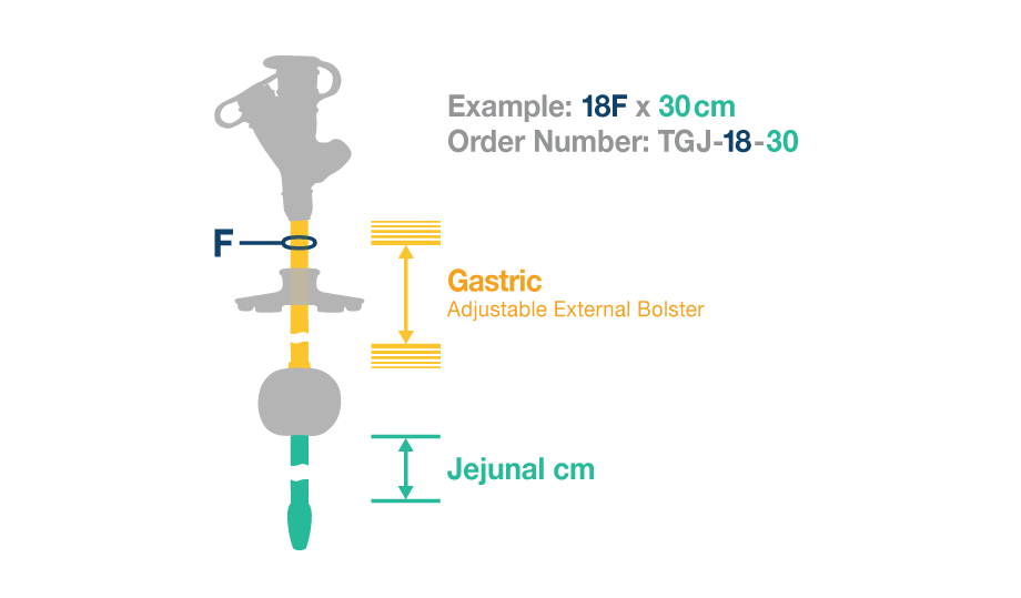 Traditional GJET® Enteral Feeding