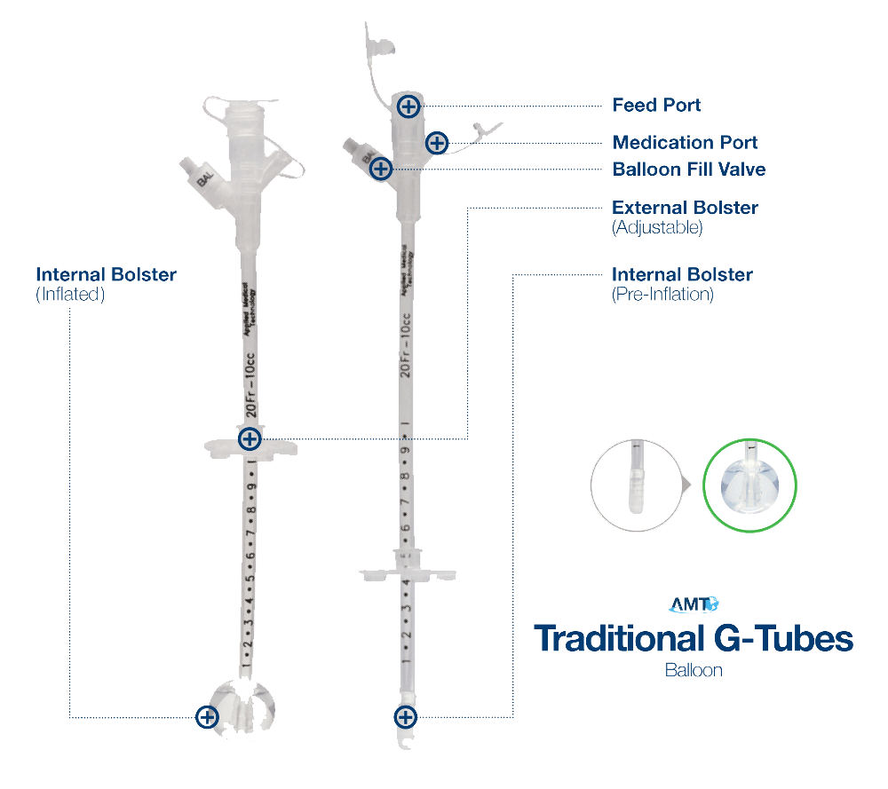 Balloon GTube Enteral Feeding