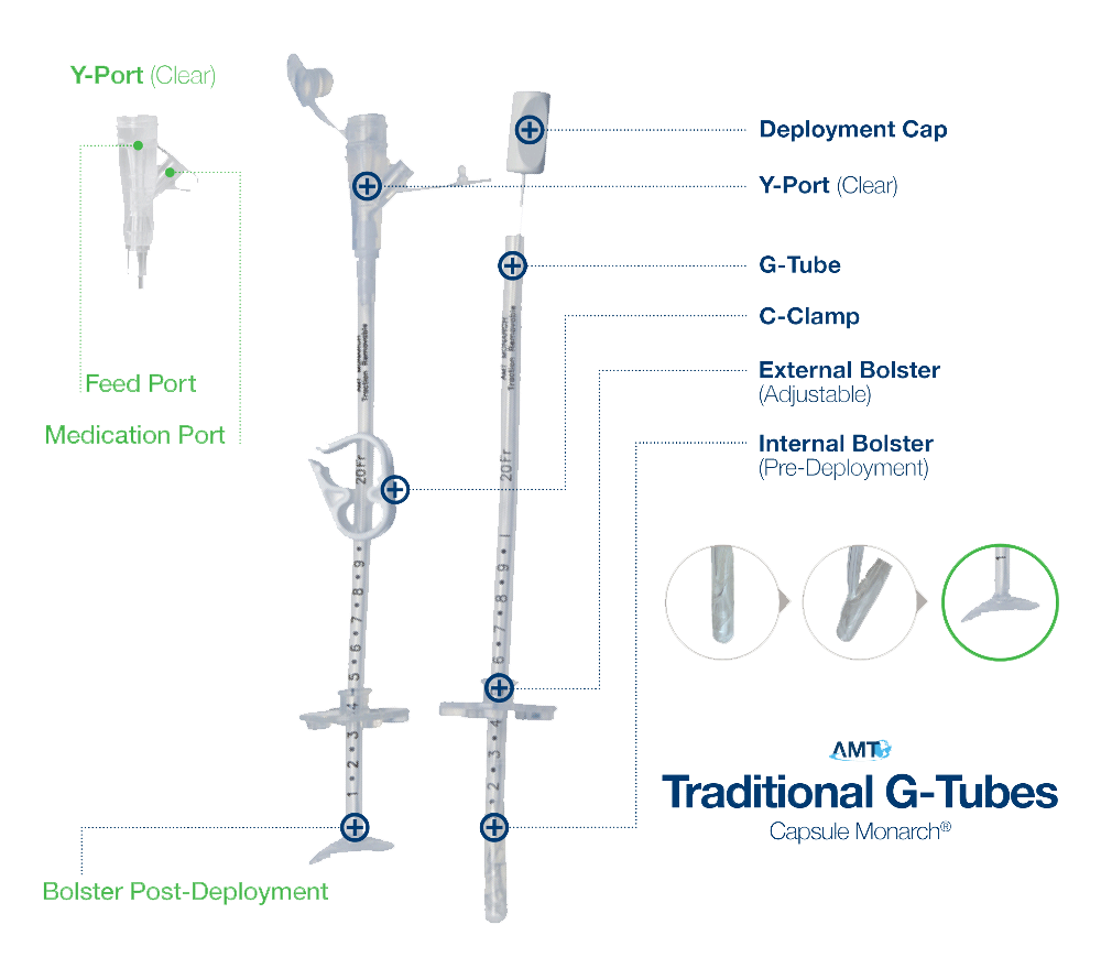 Capsule Monarch® GTube Enteral Feeding
