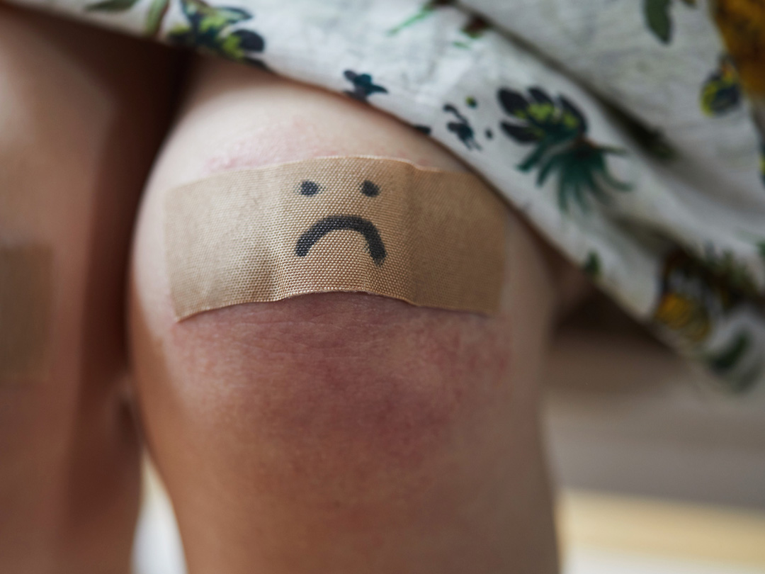 A bandage with a frown face on it worn on the knee of a light-skinned person's leg.