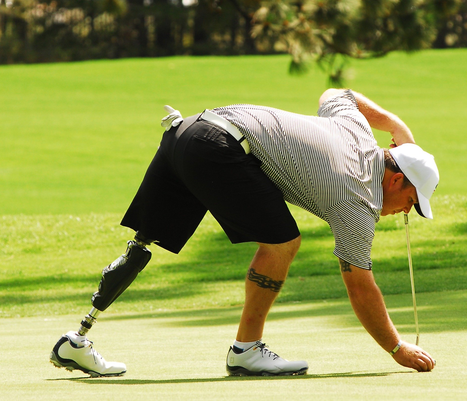 Prosthetics in Michigan | Orthotech