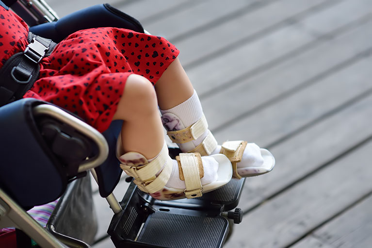 Prosthetics & Orthotics Services in Michigan Orthotech