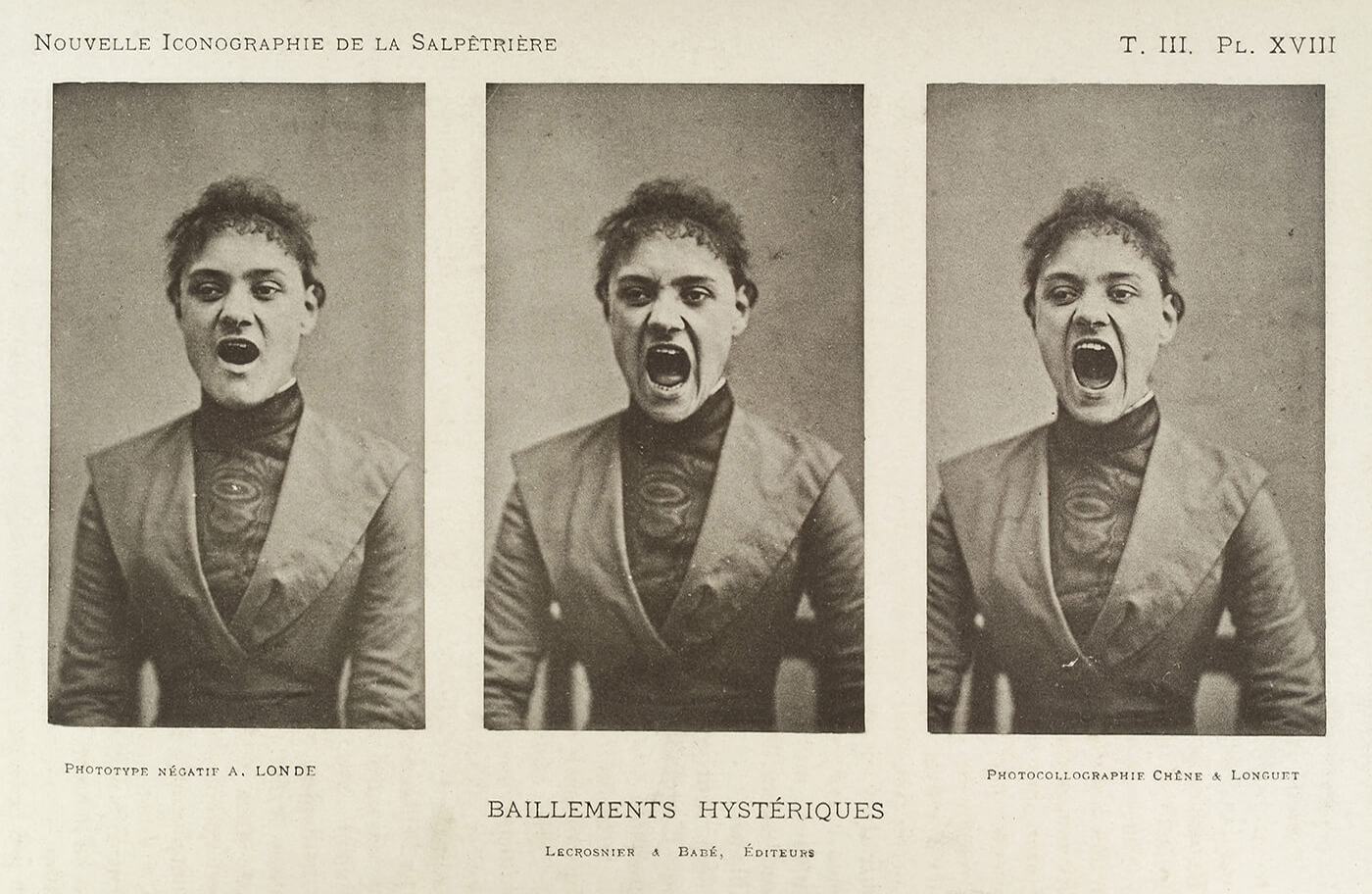 Nouvelle iconographie de la Salpêtriêre. Wellcome Collection
