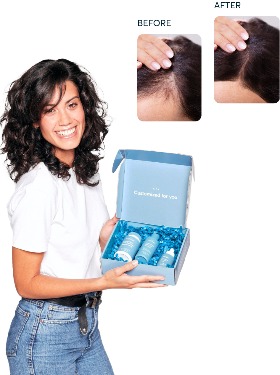 MDhair Custom Hair Regrowth Treatment