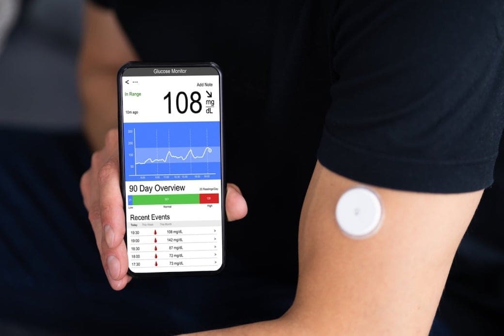 Ironisch Zu Regieren Abgelaufen Continuous Glucose Monitor Price Zaun
