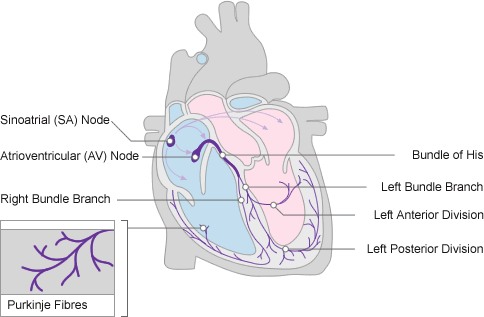 Atrial Fibrillation (1)