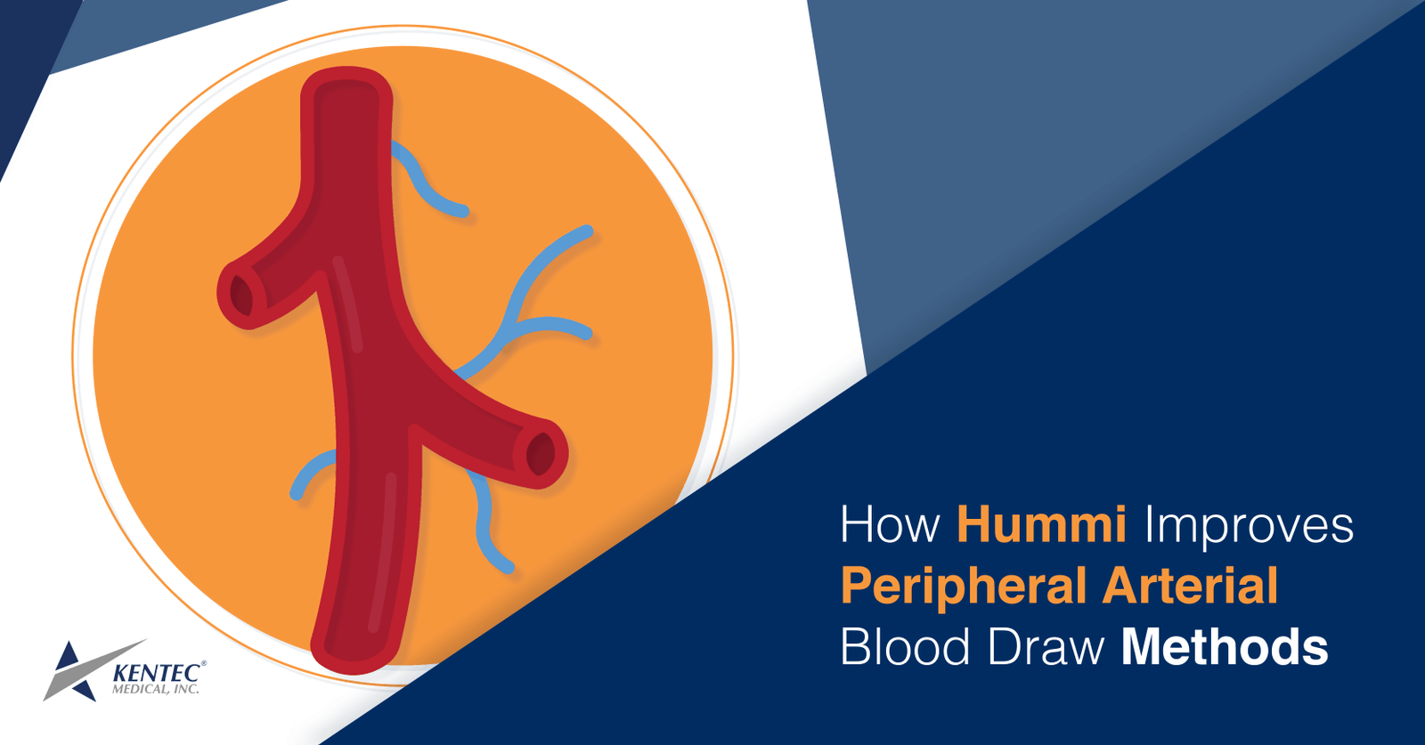How Hummi Improves Peripheral Arterial Blood Draw Methods
