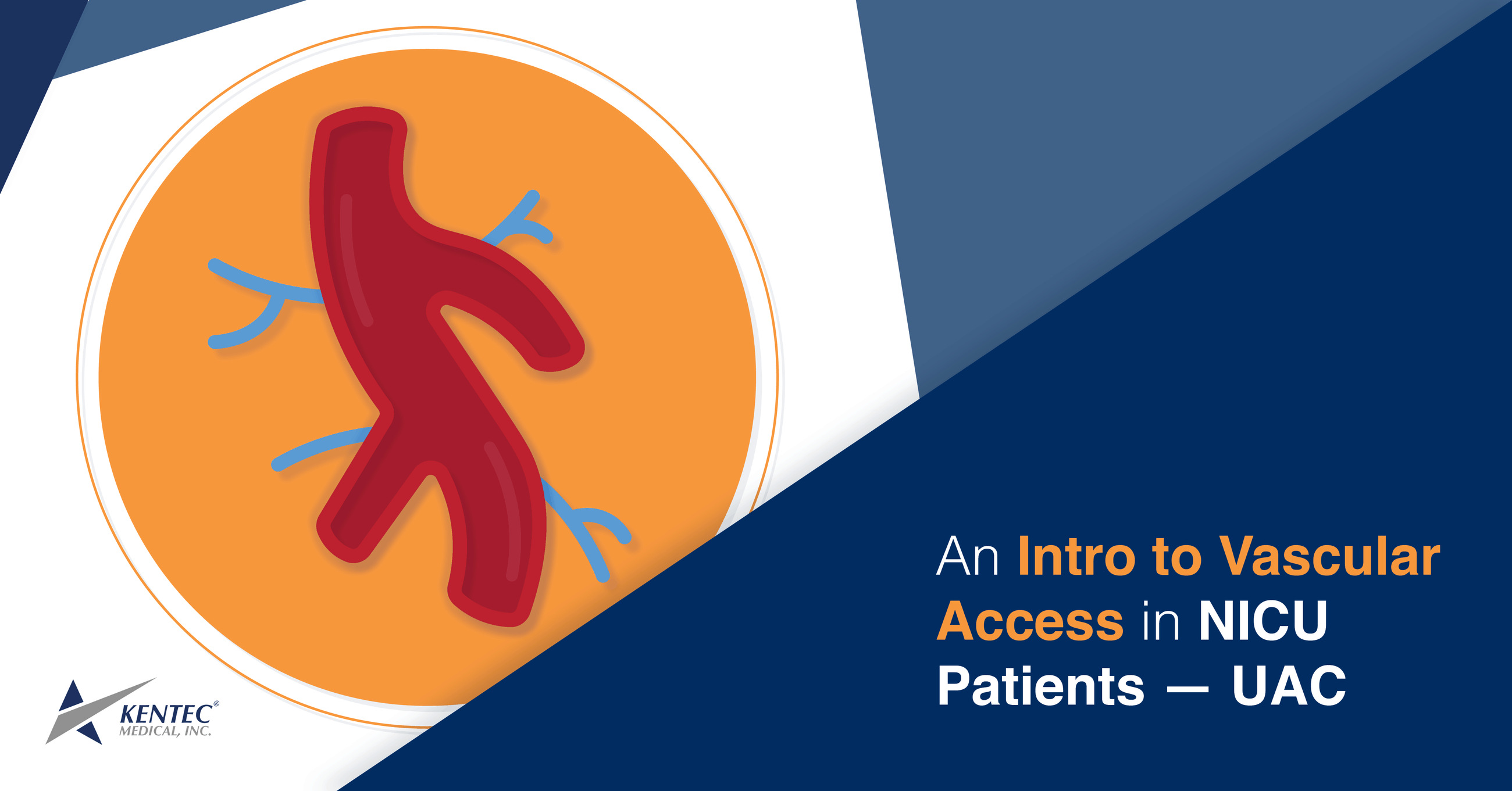 An Intro to Vascular Access in NICU Patients — UAC