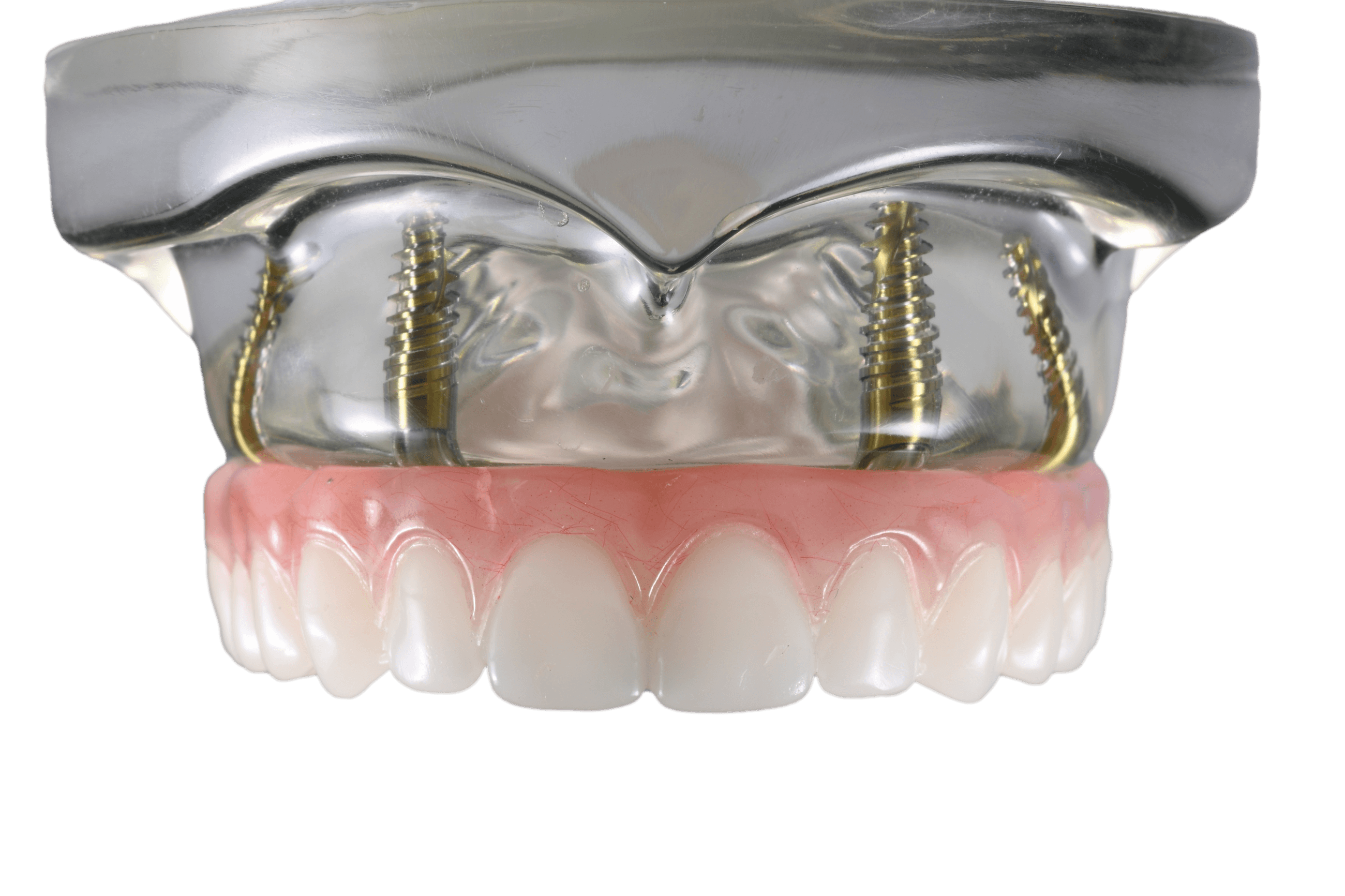 Fast, easy and affordable dentures near you