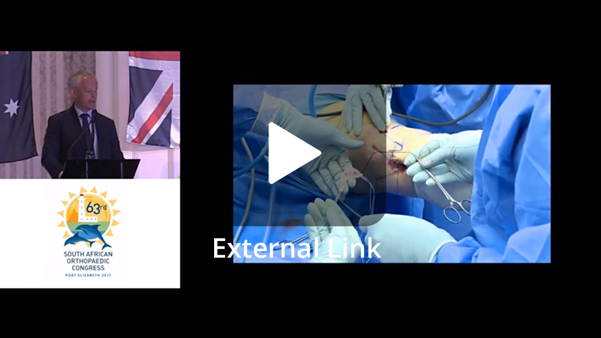 YouTube Video - Meniscal Allograft: Why, When and How