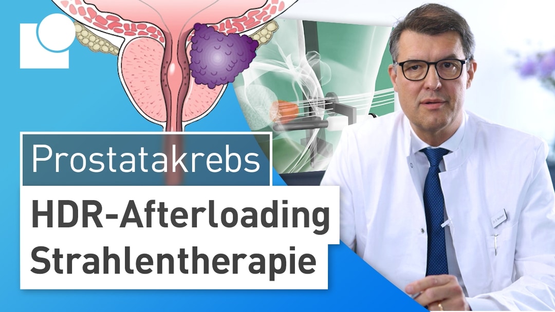 Afterloading | Prostatakarzinom