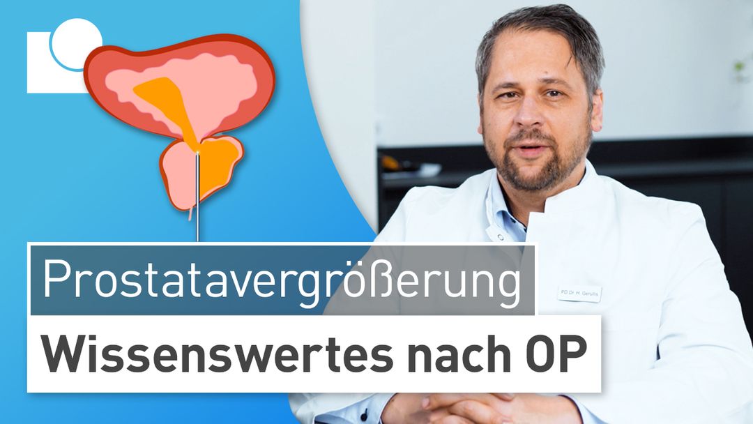 Warum Kein Sex Nach Prostata-op fr.westdeutschesprostatazentrum.de