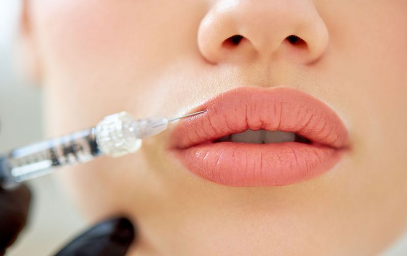 Lip Fillers & Injection Edmonton The Injectionist & Aesthetics