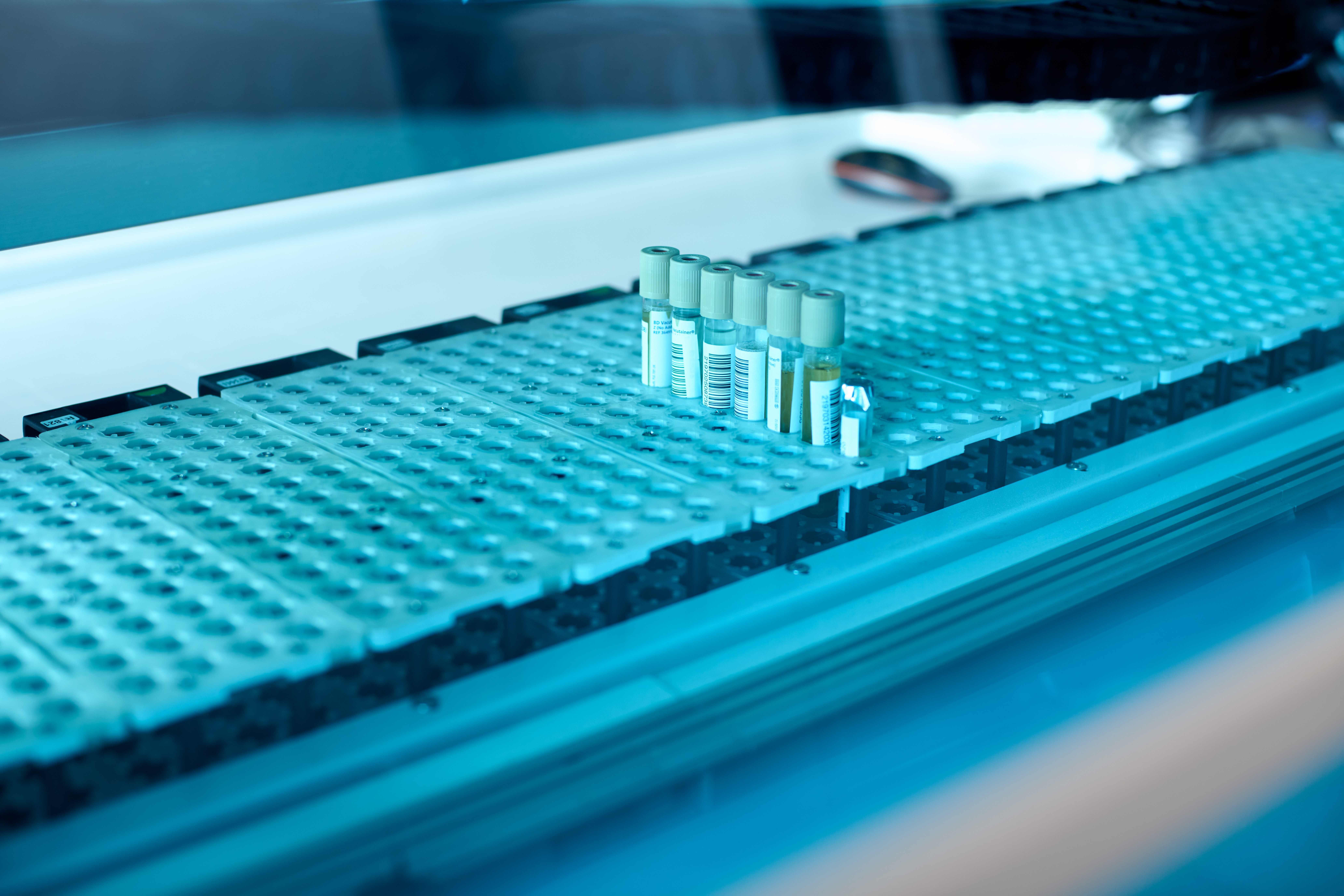 Test tubes with laboratory samples.