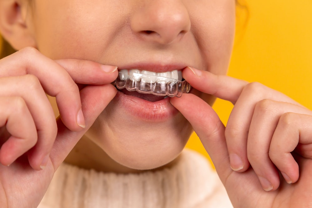 orthodontic marketing ideas