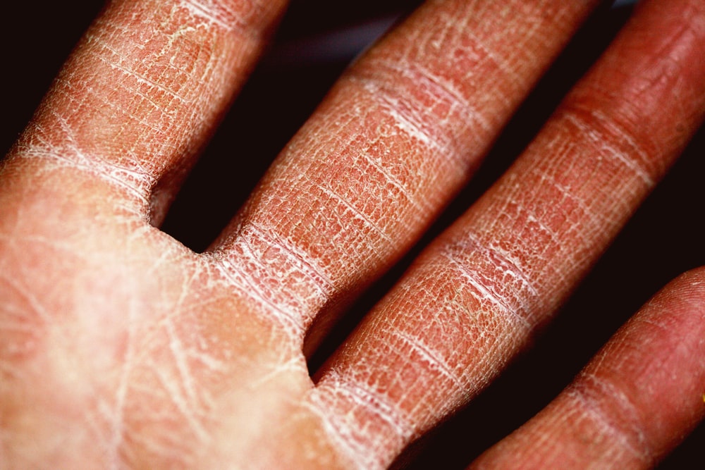 dermatology marketing ideas