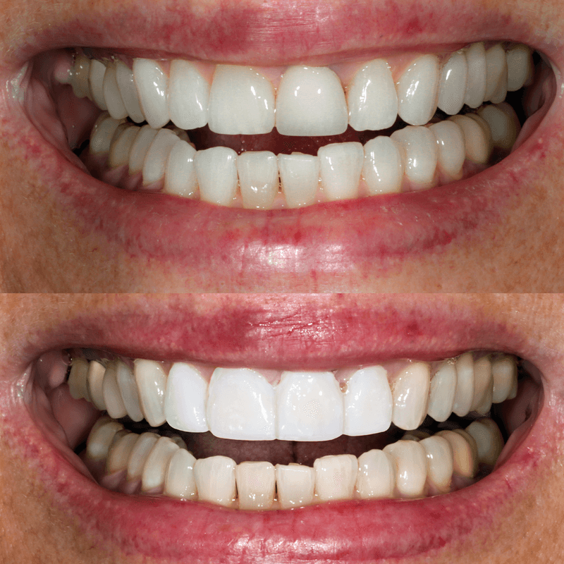 Meet the Best Dental Team In Skagit County