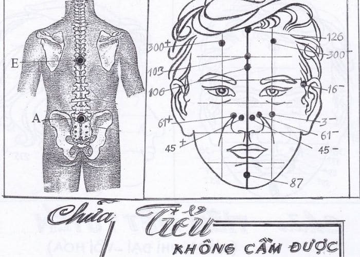 Chữa tiểu đêm bằng các huyệt trên mặt diện chẩn