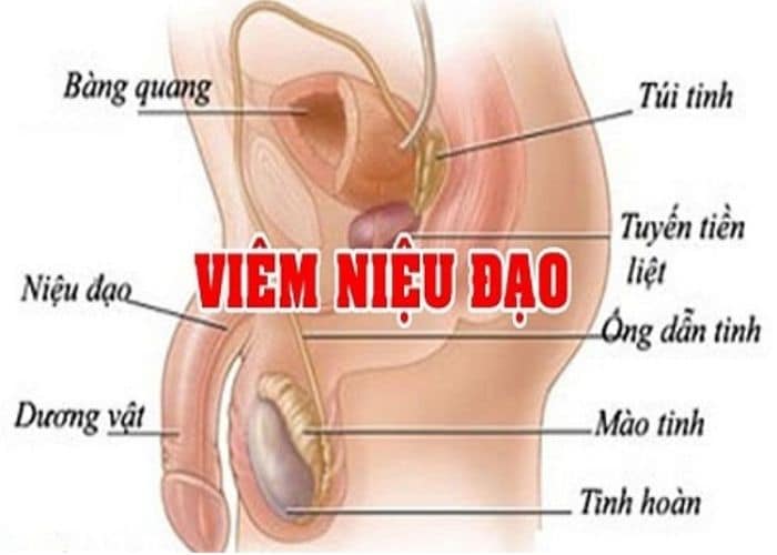 tiểu buốt tiểu ra máu ở nam giới
