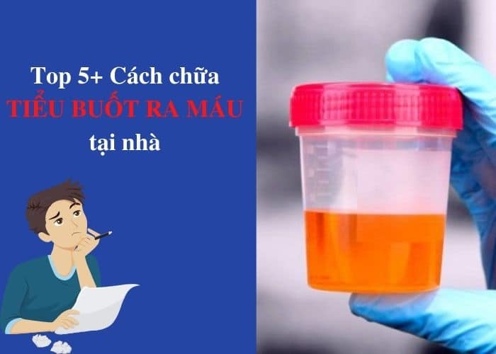 Top 5 cách chữa tiểu buốt ra máu tại nhà