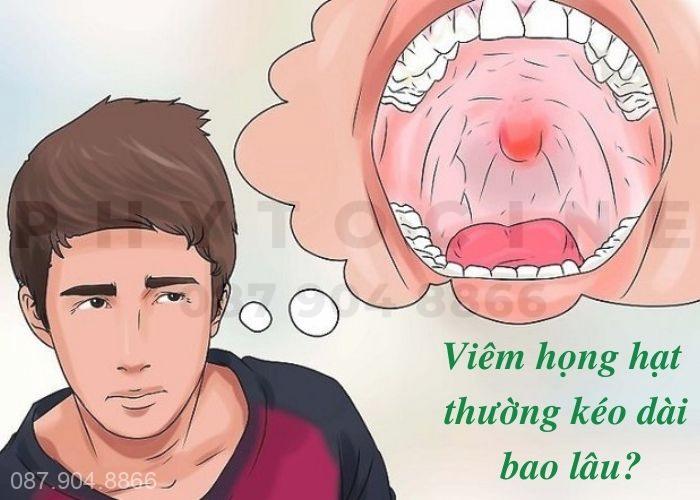 Viêm họng hạt thường kéo dài bao lâu? Làm sao để chữa khỏi dứt điểm