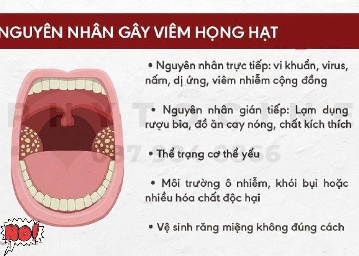 Một số nguyên nhân gây viêm họng hạt điển hình
