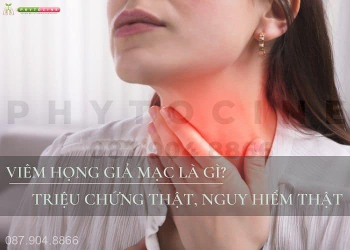 Viêm họng giả mạc là gì?